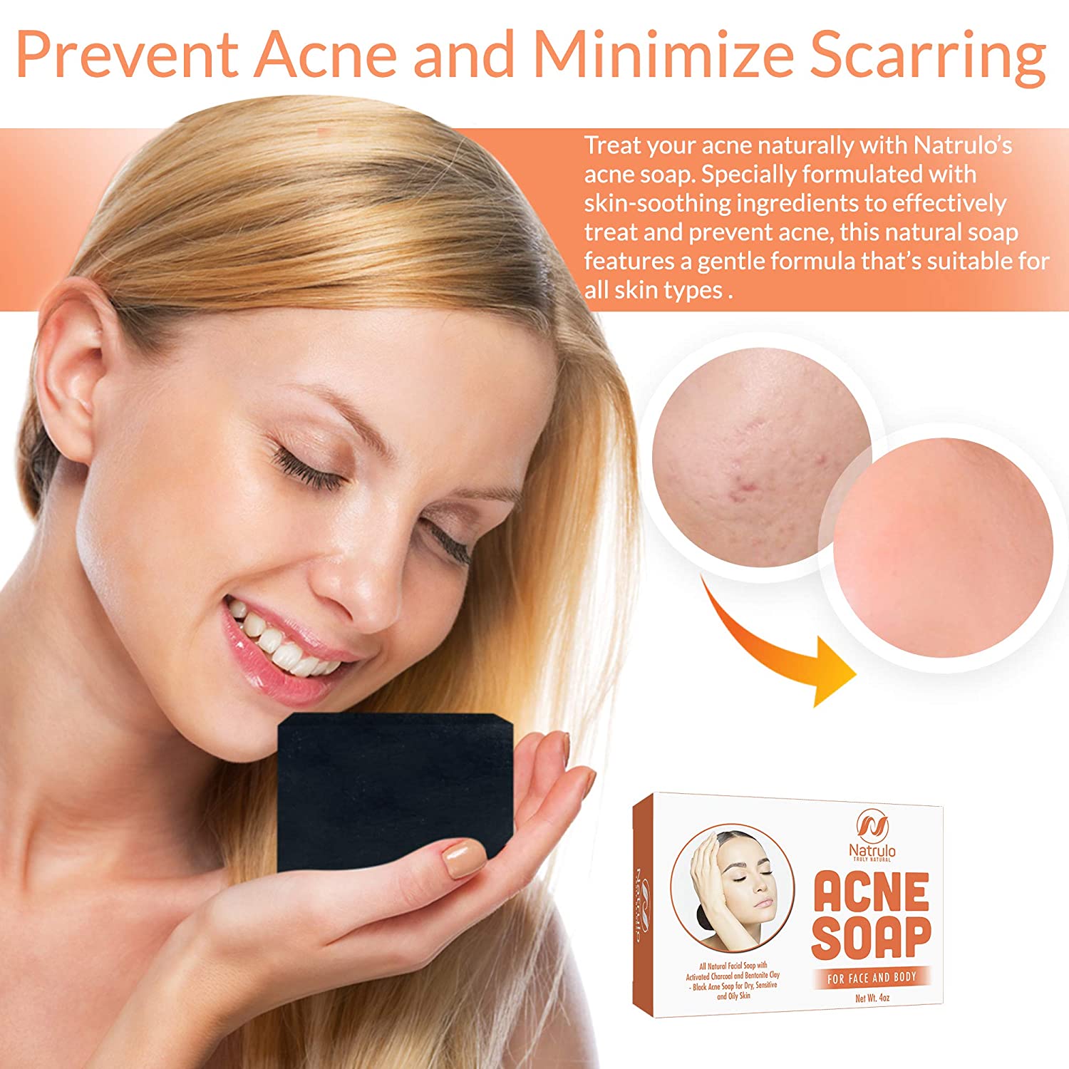 Acne deals removal soap